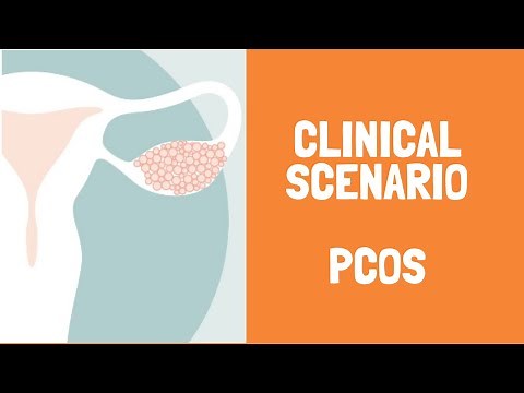 PCOS Clinical scenario- symptoms, diagnosis and treatment by Dr Shonali Chandra