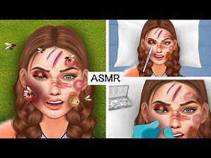 ASMR bee sting and the best treatment, remove large sebum the girl's face | 현실적인 페이셜 케어 트리트먼트 애니메이션