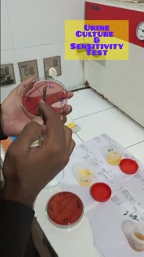 Urine Culture and Sensitivity Test | Urine for C/S #microbiology #urineforcs #urine #culture #test