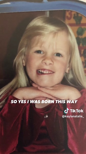 I was born with facial paralysis #facialparalysis #acf