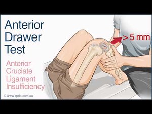 Anterior Drawer Test - A Chiropractic Online CE™ Production