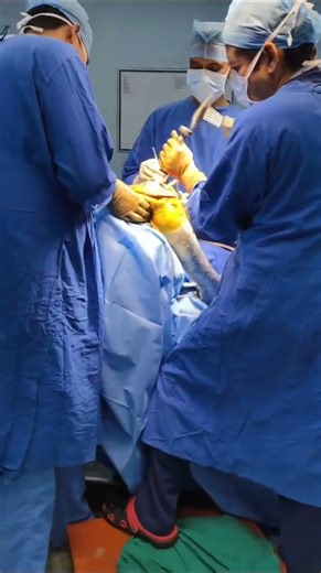 o.t. room sound | ortho tech sound 😱 | #ottechnician #ottechnician #hospital #hospital#youtubeshorts