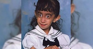 A brave heart: Woman famous for her looks becomes a motivational speaker, turning her pain into strength