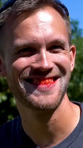 His teeth 😅 #candy #science #experiment #sugar #thekingofrandom #reels | The King of Random