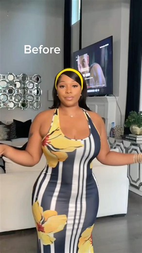 No surgery. No waiting. Just curves. 🍑✨ With removable hip pads, you’re in control.