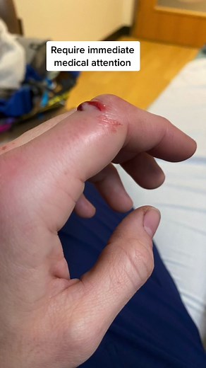 Dealing with a Cat Bite: Tips from a Veterinarian