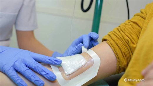 Tunneling vs. Undermining Wound | Definition & Overview - Video | Study.com