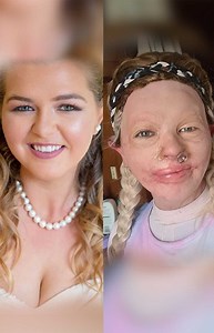 11M views · 601 reactions | "I fell face-first into a camp fire" | Shake My Beauty | Facebook