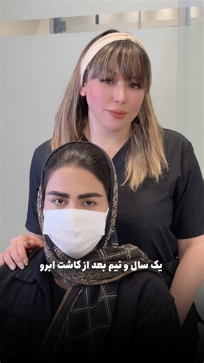 ‎کاشت ابرو/کاشت مو/الی منفرد/شیراز‎ on Instagram‎: "نتیجه کاشت ابرو بعد از ۱۸ ماه ⏳ تثبیت کامل گرافت‌ها، رشد طبیعی و خواب صحیح موها @kasht_abroo_elimonfared @kasht_abroo_mana بدون ریزش مجدد، بدون تغییر فرم ✨ ماندگاری واقعی یعنی همین ✔️ . . جهت رزرو نوبت و مشاوره رایگان کلمه «مشاوره» رو کامنت کنید🤍 #کلینیک_کاشت #کاشتمووابرو #کاشت_ابرو #کاشتابرو #کاشتابروطبیعی"‎