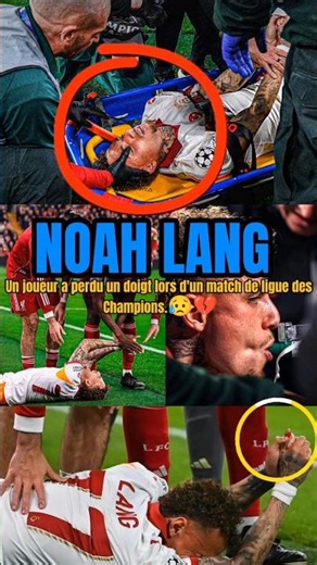 A player lost a finger during a Champions League match. 😥💔