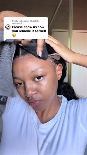 How to Safely Remove Wig Without Damaging Hairline