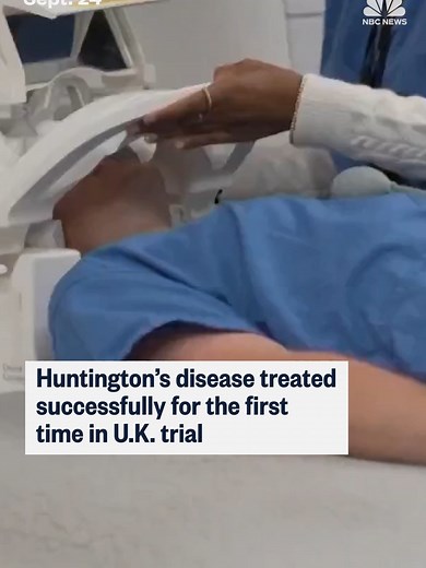 An experimental gene therapy has been found to slow the progression of Huntington’s disease, according to drugmaker uniQure, a major step towards the first genetic treatment for the genetic and fatal condition.