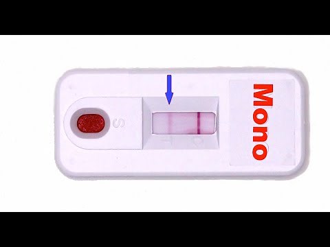 Rapid Mono Test: How Does it Work?
