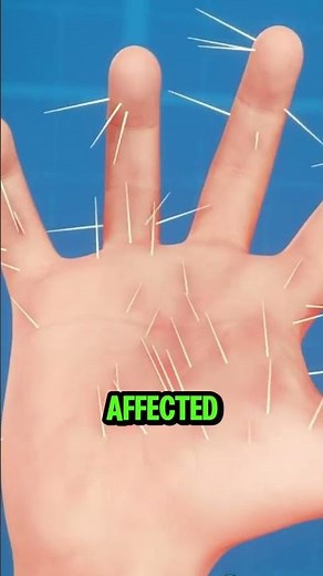 How to Remove Cactus Spines Safely 🌵