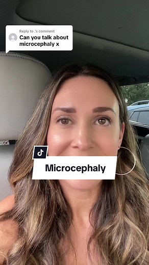 Understanding Microcephaly: Causes, Symptoms, and Treatment