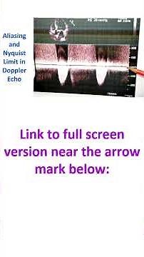 Aliasing and Nyquist Limit in Doppler Echo