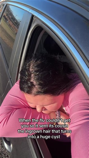 Dealing with Ingrown Hairs and Cysts on Inner Thighs