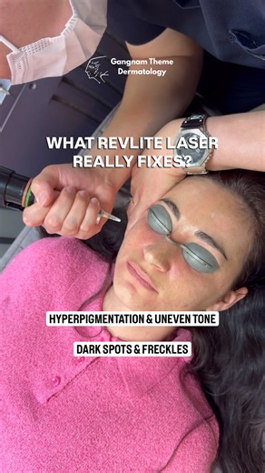 What Revlite Really Fixes? Here’s the truth! 👇🏻 Revlite isn’t just a brightening laser, it’s a powerful treatment designed to target deep skin concerns while keeping your glow looking natural and even. ☑️ Fades dark spots and sun pigmentation ☑️ Treats acne marks and stubborn PIH ☑️ Minimizes pores for smoother texture ☑️ Brightens dull, uneven skin tone ☑️ Boosts collagen for youthful radiance ☑️ Helps reduce fine lines and early aging signs Ready for clearer, brighter, more confident skin? �