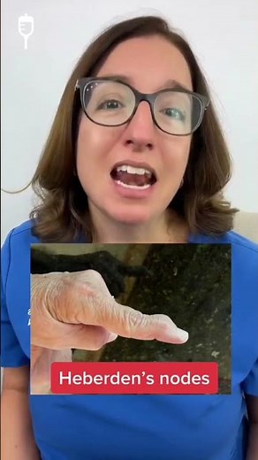 Heberden's nodes: Medical-Surgical SHORT | ‪@LevelUpRN‬