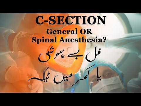 C-SECTION: General or Spinal Anesthesia