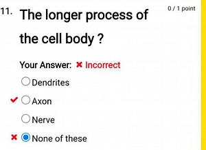 The longer process of the cell body?DendritesAxonNerveNone... | Filo