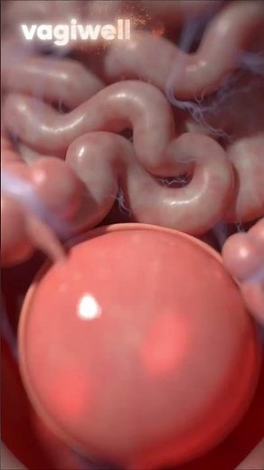 Interstitial Cystitis: Hidden Bladder Pain Signs