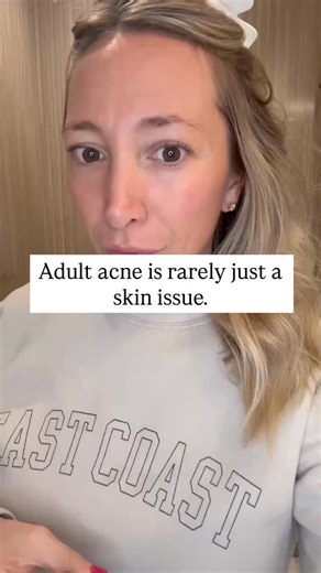 Non Toxic Homes on Instagram: "Adult acne is often treated like a surface problem. Topicals. Spot treatments. Antibiotics. Hormone suppressors. But for many people, persistent breakouts are a signal, not a skincare failure. When the gut is under chronic stress — from inflammation, dysbiosis, impaired digestion, or cumulative toxic load — it can directly affect hormone metabolism, immune signaling, detox pathways, and nutrient absorption. And the skin is often where that imbalance shows up first.