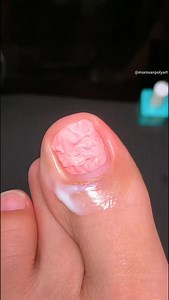 47K views · 408 reactions | I thought gel nail removal was supposed to be hardâ€¦ not anymore. #NailTok #trending #gelremoval #nailremover #foryoupage #nailpolish #morovannailpolishremover #nailtutorial #nailvedios | Eshal Moreno | Facebook