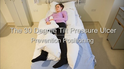 30 DEGREE TILT PRESSURE ULCER PREVENTION POSITIONING VIDEO-HD 1080p