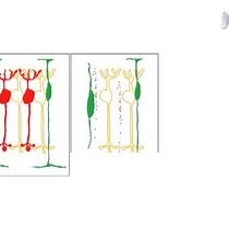 Video: Multicolor Time-lapse Imaging of Transgenic Zebrafish: Visualizing Retinal Stem Cells Activated by Targeted Neuronal Cell Ablation