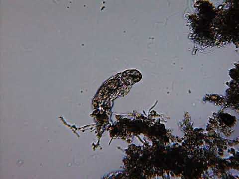 下水処理場で活躍する微生物 クマムシ