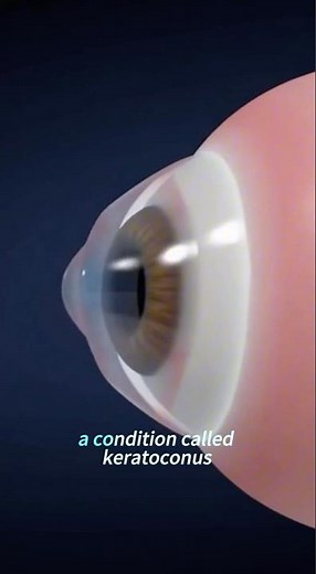 What Happens When You Rub Your Eyes 👁️ #eyes #health #rubbingeyes #3danimation #fyp