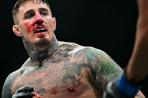 Tom Aspinall still can’t see in right eye four days after eye poke at UFC 321