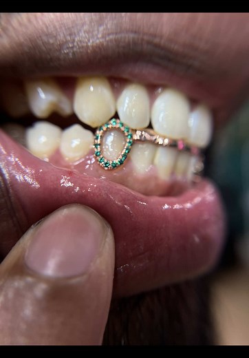 Femme Gemz Jewelry (@femme_gemz) - Custom Tooth Gems and Permanent Jewelry in Bucks County