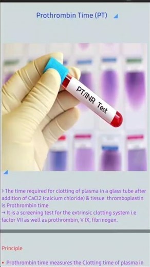 Prothrombin time principle, procedure and clinical significance #shortvideo #shorts