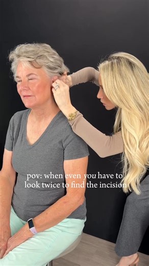 Dr. Berry Fairchild | Plastic Surgeon | HTX on Instagram: "“Where are my incisions?” One of my favorite questions. I place them along Langer’s lines and natural folds to minimize tension, and long term visibility. What do you want to know about incision placement?"