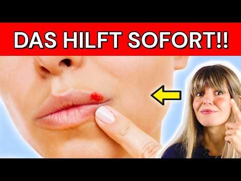 So verschwindet Herpes SCHNELL *Ernährungstipps