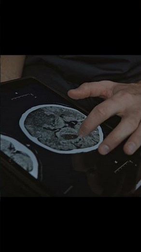 Free Online DICOM Viewer: Open MRI & CT Scans in Browser (No Install)