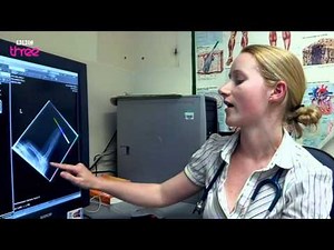 Help Me! I've stuck a needle through my finger! - Bizarre ER - BBC