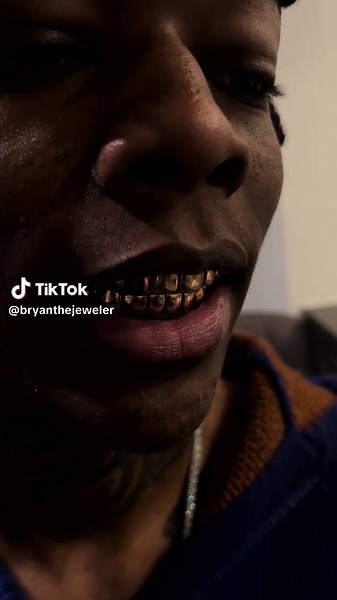 Rose Gold Grillz I made for HeemBeezy in 2024 I believe. A lil sum from my archives . #fyp #grillz #fy #foryoupage #heembeezy