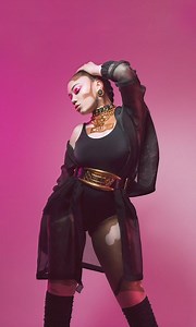 832K views · 487 reactions | My vitiligo didn't stop me becoming a model ✨ | Shake My Beauty | Facebook