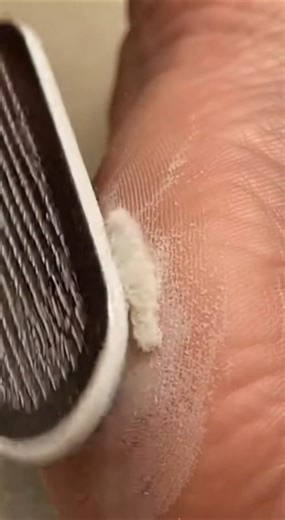 “Foot File Dust Removal | Satisfying Dry Skin 4K” #satisfying #skincare