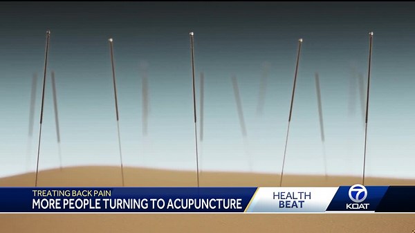 Health expert breaks down acupuncture treatment