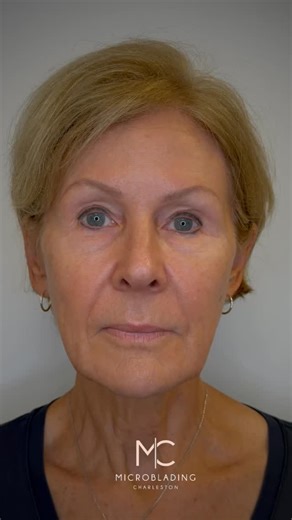 Brow correction time ✨ Every artist has their own touch — different techniques, different styles, different magic. That’s why every correction is unique — we simply enhance what’s already there and make it fit you perfectly. 💫 Our clients trust us for a reason — years of experience, precision, and true professionalism in every stroke. ❤️ #browcorrection #browtouchup #PowderBrows #MicrobladingCharleston #CharlestonBeauty #PMUArtist #PermanentBrows #CharlestonSalon #BrowTransformation #NaturalBro