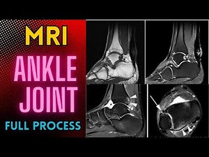 MRI Ankle Joint- Patient positioning, Slice planning and filming techniques full tutorial