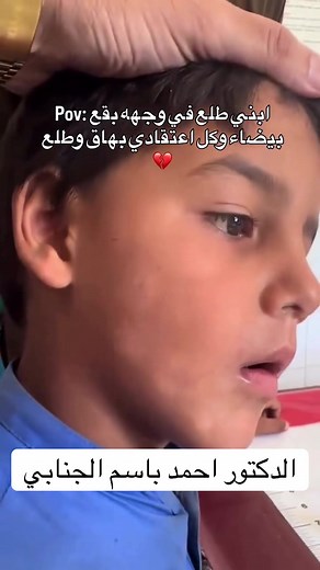 ما هو المرض الجلدي Pityriasis alba؟