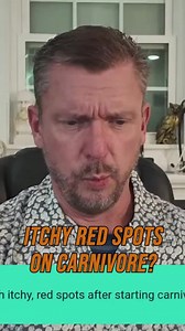 Itchy Red Spots On Carnivore? 👉 | Ken Berry