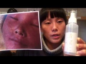 【おすすめ】重症アトピーの時に使っていた「スキンケア５選」【アトピー研究34年】