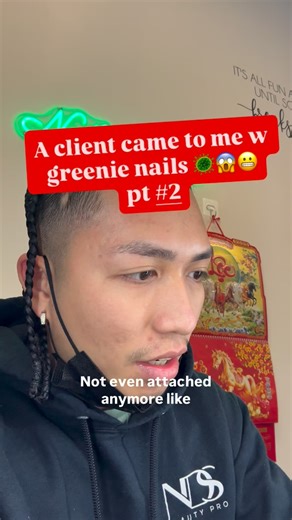 Vỹ Lê 🇻🇳🇰🇭 on Instagram: "A client came to w greenie nails 🦠😱😬 Pt#2 UPCOMING WORKSHOPS DALLAS / FEB 23-24 📌 Ripley, TN / MARCH 22-23 📌 LINK IN BIO TO RESERVE SEAT DM FOR MORE INFO ❗️❗️❗️ Products using ⬇️ @notpolish_nails / DISCOUNT CODE “Vy” @pla_nails / DISCOUNT CODE “ VY20 “ @chaunlegendnails / “ Vy10 “ @onail_official AI nail lamp + drill / DISCOUNT CODE “ VY100 ” BOOKING APPOINTMENT LINK IN BIO http://nailprofessorvllc.square.site/ NailprofessorvLLC • 4514 Breton Rd SE SUITE #3 Ken