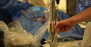 Health Beat: The future of cardiac care